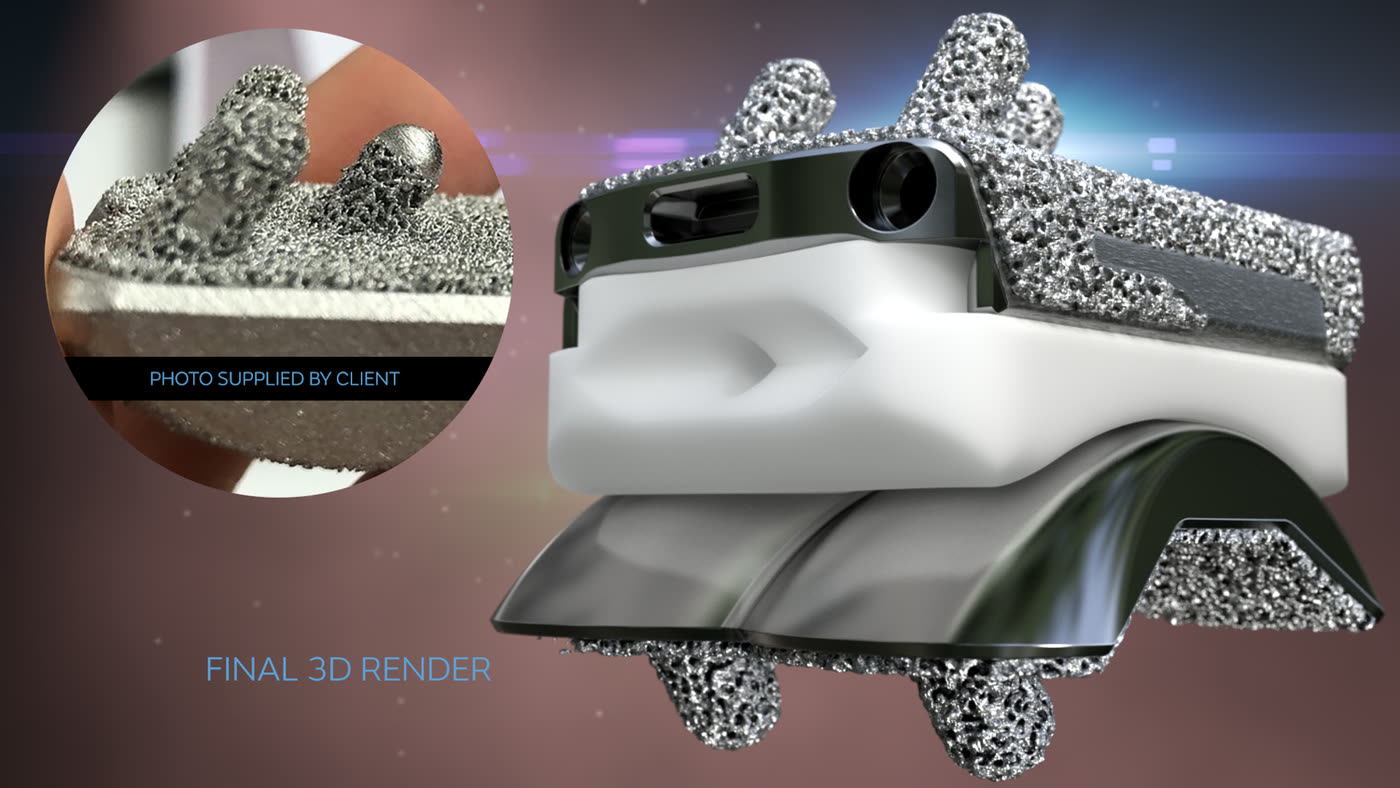 Porous implant render